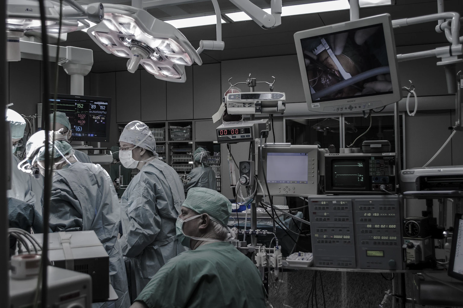 Equipe cirúrgica em sala de operação com monitores de vídeo durante cirurgia minimamente invasiva