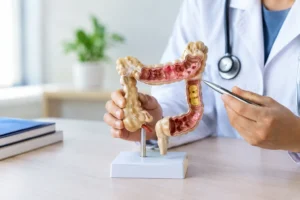 Sintomas e tratamento do câncer intestinal